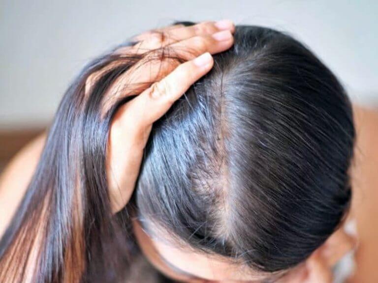 進行植髮手術前要考慮甚麼條件？