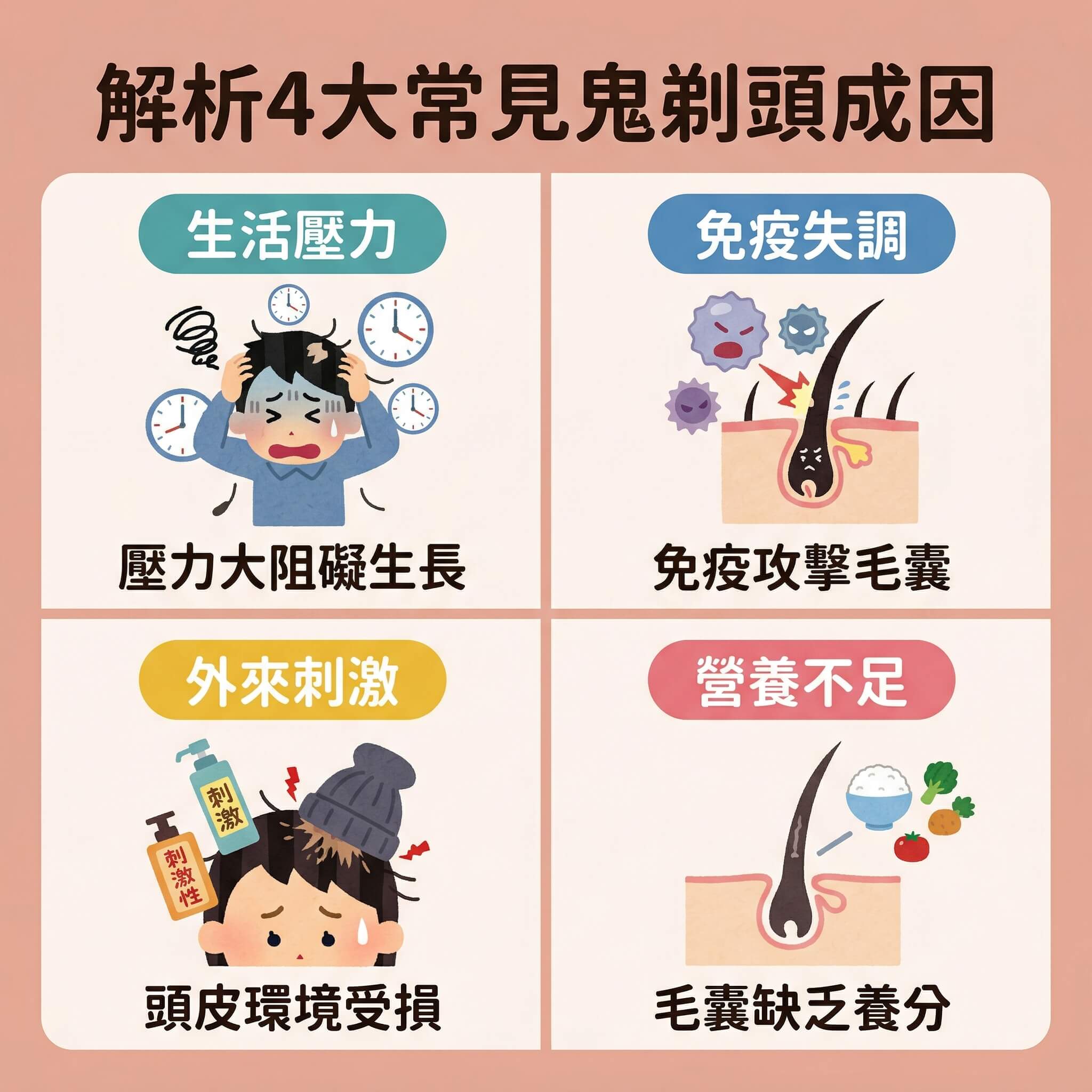 這是一張1:1正方形扁平化向量資訊圖表（Infographic），整體設計排版整潔，採用現代醫療健康教育風格及日系/台系的可愛卡通感。插圖嚴格運用 Irasutoya（いらすとや）風格。背景顏色使用柔和的 #E5B1A1 色系。排版採用彈性網格佈局，利用淺色直線將畫面劃分為4個整齊的方格。頂部標題為「解析4大常見鬼剃頭成因」，且標題下方沒有任何額外的標籤。

此圖表主旨為鬼剃頭原因分析，探討突然局部脫髮及圓形禿頭症狀。
第一格展現「生活壓力」，插圖描繪精神壓力大脫髮與心理創傷的意境，指出精神壓力如何引起情緒波動引發脫髮，甚至導致荷爾蒙與內分泌失調甩頭髮的問題。
第二格為「免疫失調」，插圖呈現免疫系統攻擊毛囊的過程，涉及自體免疫疾病、自體免疫疾病併發、甲狀腺疾病與甲狀腺功能異常脫髮，展現免疫系統中的白血球或細胞攻擊引發炎症反應，導致頭皮毛囊發炎及斑禿初期徵狀識別，同時強調尋求皮膚科醫生進行皮膚科專科診斷的重要性，並關聯至遺傳基因、家族病史與家族遺傳性斑禿。
第三格為「外來刺激」，插圖反映頭皮環境受損導致斑禿及異常脫髮，帶出需要改善頭皮血液循環與促進血液循環的健康概念，並建議配合專業頭皮檢測分析。
第四格為「營養不足」，插圖表現營養缺乏影響頭髮生長週期，呼籲必須促進頭髮生長週期及刺激毛囊重新生長，以預防鬼剃頭復發。圖表整體帶出尋求專業醫學活髮治療方案與鬼剃頭治療方法，從而保護毛囊及改善鬼剃頭的教育訊息。