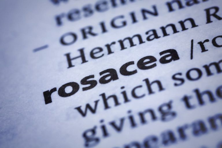 玫瑰痤瘡 vs 暗瘡的病徵？