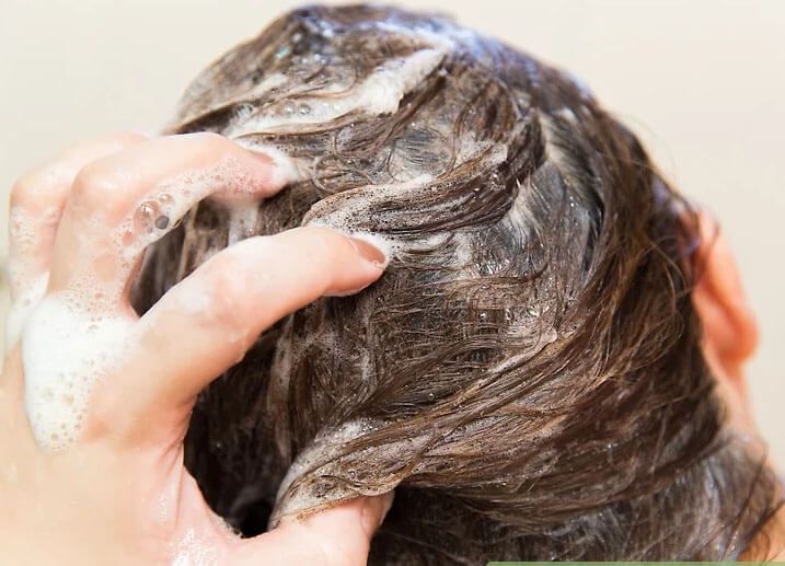6個預防髮旋禿的方法！快點照做吧！