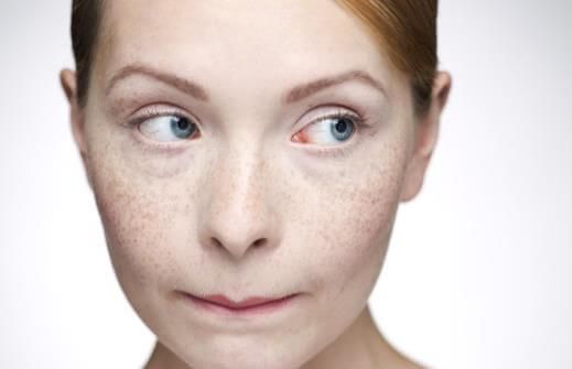 去斑方法「逐個捉」：中醫推介去斑食療