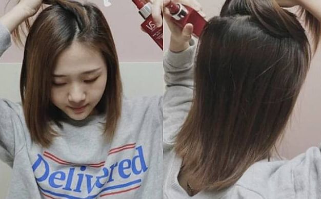 有效治療前額脫髮的方法！Perfect Medical F8 生髮療程